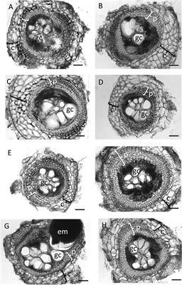 Infection of Medicago truncatula by the Root-Knot Nematode Meloidogyne javanica Does Not Require Early Nodulation Genes